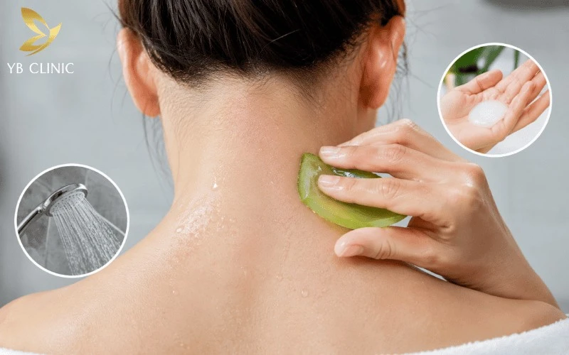 Triệt Lông Gáy Là Gì? Triệt Lông Gáy Có Tốt Không? 14 Chăm sóc đúng cách sau triệt lông gáy giúp làm dịu da, hạn chế kích ứng và duy trì vùng cổ sau mịn màng, khỏe đẹp.