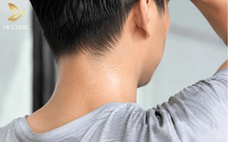 Triệt Lông Gáy Cho Nam Và Nữ Có Nên Không? Lợi Ích Và Rủi Ro Cần Biết 8 Triệt lông gáy giúp hạn chế mồ hôi và bụi bẩn lưu lại trên sợi lông, từ đó hỗ trợ giảm mùi khó chịu vùng sau cổ.
