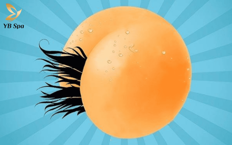 Triệt lông hậu môn vĩnh viễn không chỉ vì thẩm mỹ mà còn là bước đầu tư quan trọng cho vệ sinh cá nhân và sức khỏe vùng kín