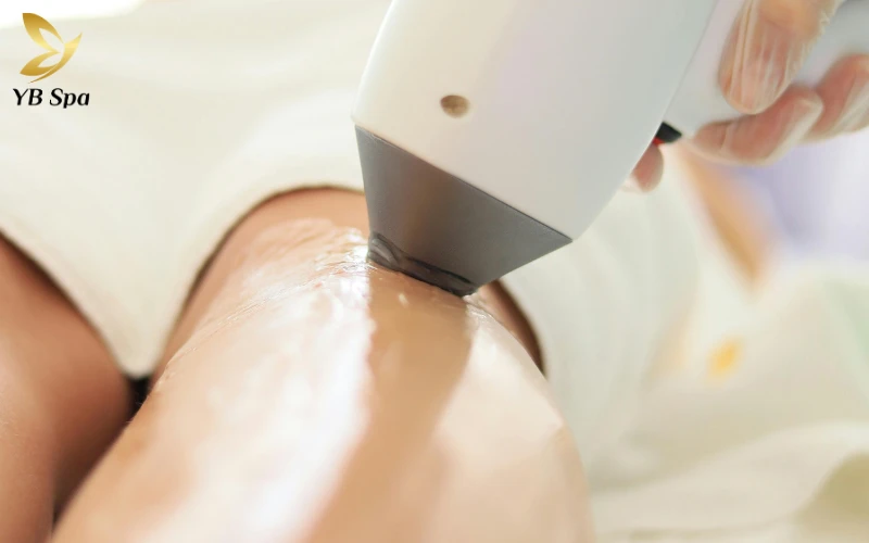 Triệt lông lạnh có tốt không? So sánh triệt lông nóng và lạnh 20 Triệt lông lạnh