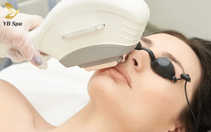 Triệt lông lạnh có tốt không? So sánh triệt lông nóng và lạnh 22 Hiệu quả trong việc loại bỏ lông vĩnh viễn