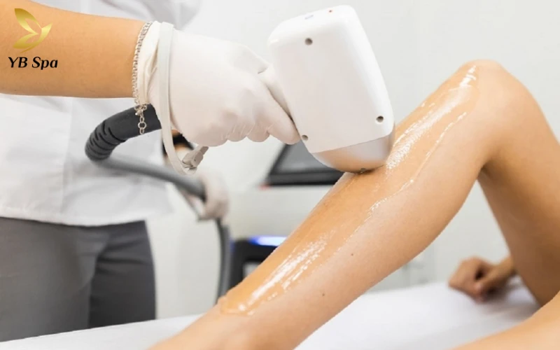 Triệt Lông Lạnh Diode Laser Là Gì? Cơ Chế Hoạt Động Của Diode Laser Lạnh 20 Triệt Lông Lạnh Diode Laser Là Gì