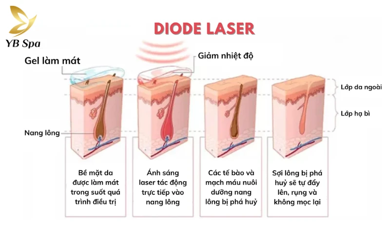Triệt Lông Lạnh Diode Laser Là Gì? Cơ Chế Hoạt Động Của Diode Laser Lạnh 21 Cơ Chế Hoạt Động Của Diode Laser Lạnh