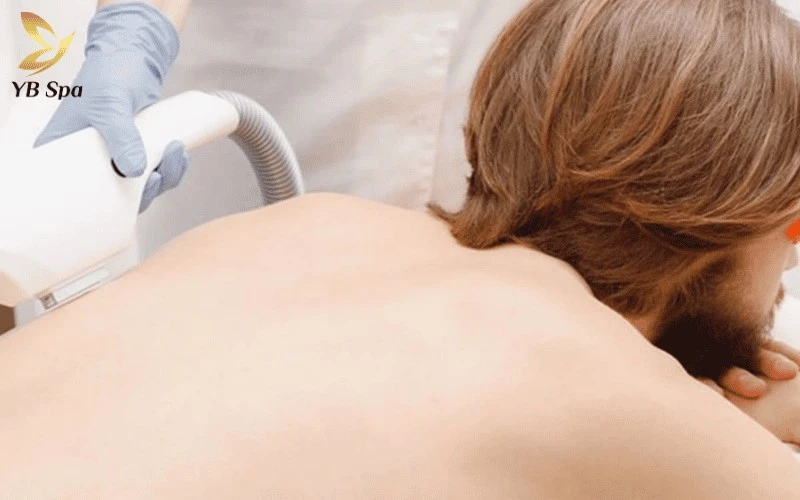 Cảm nhận hiệu quả rõ rệt chỉ sau 3-4 buổi khi sợi lông bắt đầu mọc thưa, mỏng và nhạt màu thấy rõ.