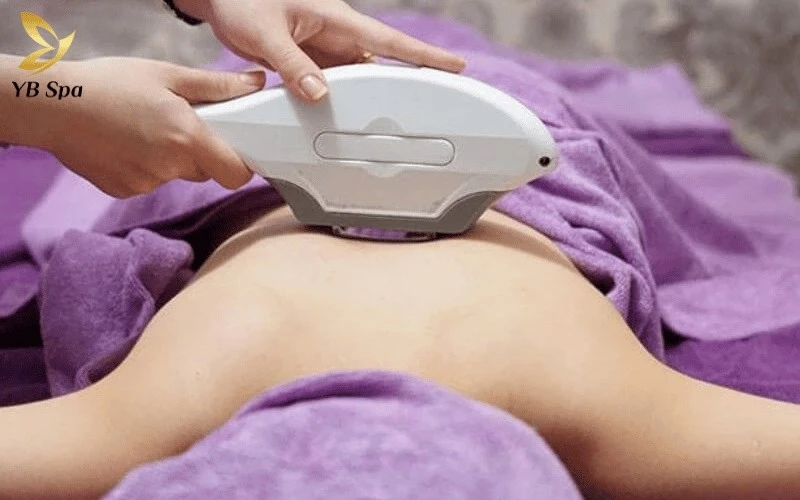 Khắc phục triệt để tình trạng lông mọc ngược vùng lưng chỉ sau 3 buổi thực hiện với quy trình bài bản tại Linh Anh