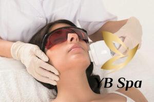 Triệt lông mặt với công nghệ Laser tiên tiến có tại YB SPA (Nguồn: YB SPA)