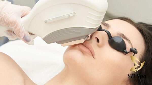 Có nên tẩy lông mặt không? (Nguồn: Internet)