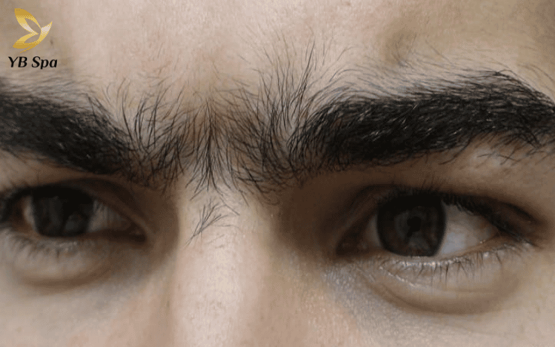 Triệt lông mày giao nhau - Bí quyết cho đôi lông mày thanh tú 9 Khoảng cách giữa hai đầu chân mày được khai thông sẽ giúp gương mặt bớt dữ dằn, trở nên hiền hòa và dễ gây thiện cảm