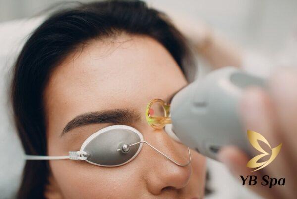 Triệt lông mày giao nhau