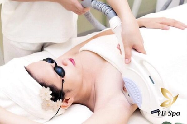 Triệt lông nách bằng laser sử dụng ánh sáng laser để phá hủy nang lông (Nguồn: Internet)
