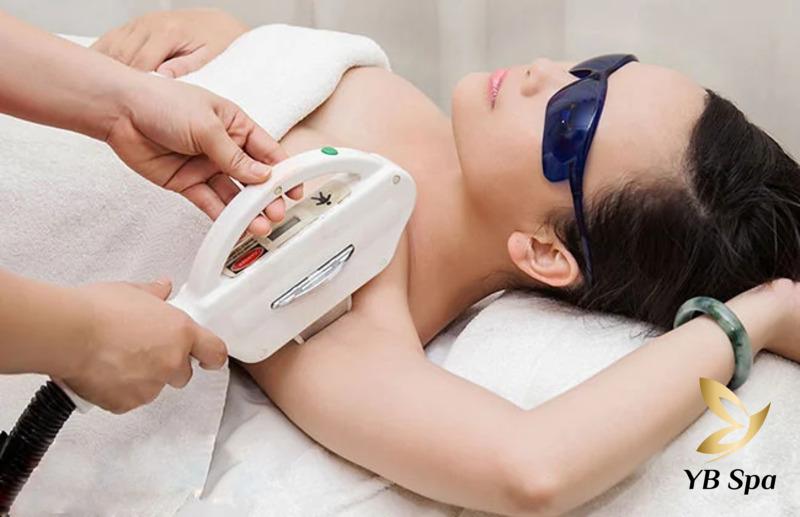 Triệt lông nách tại YB Spa không gây thâm nách