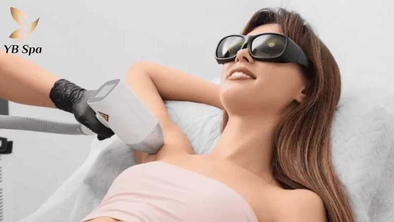 Triệt Lông Nách Bao Nhiêu Lần Thì Hết? Khoảng Cách Và Yếu Tố Quyết Định 8 Liệu trình triệt lông nách thường kéo dài từ 6-10 buổi để đạt hiệu quả dọn cỏ vĩnh viễn, an toàn.