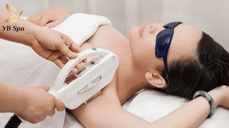 Triệt Lông Nách Bao Nhiêu Lần Thì Hết? Khoảng Cách Và Yếu Tố Quyết Định 9 Lựa chọn công nghệ triệt lông hiện đại như Diode Laser hay IPL quyết định trực tiếp đến tổng số lần triệt.