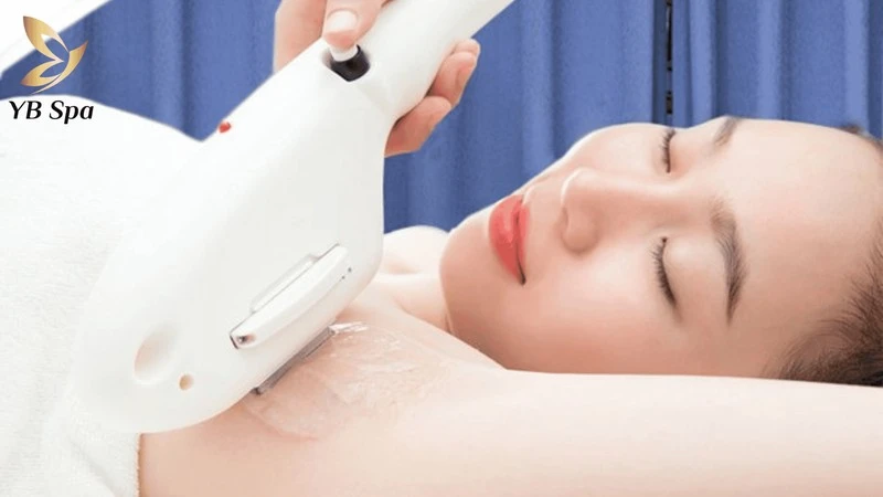 Triệt Lông Nách Bao Nhiêu Lần Thì Hết? Khoảng Cách Và Yếu Tố Quyết Định 11 Duy trì khoảng cách 3-4 tuần giữa các buổi triệt lông nách giúp tiêu diệt nang lông hiệu quả triệt để nhất.