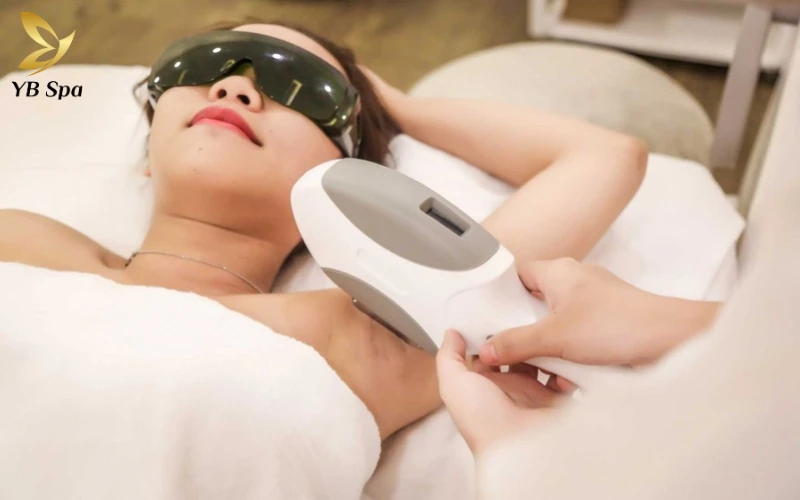 Triệt Lông Nách Có Giảm Mồ Hôi Không?