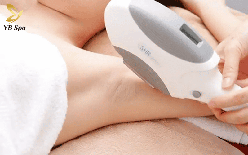 Triệt lông vĩnh viễn giúp loại bỏ hoàn toàn các tác động cơ học như cạo/nhổ, cho phép làn da dưới cánh tay có thời gian tự chữa lành