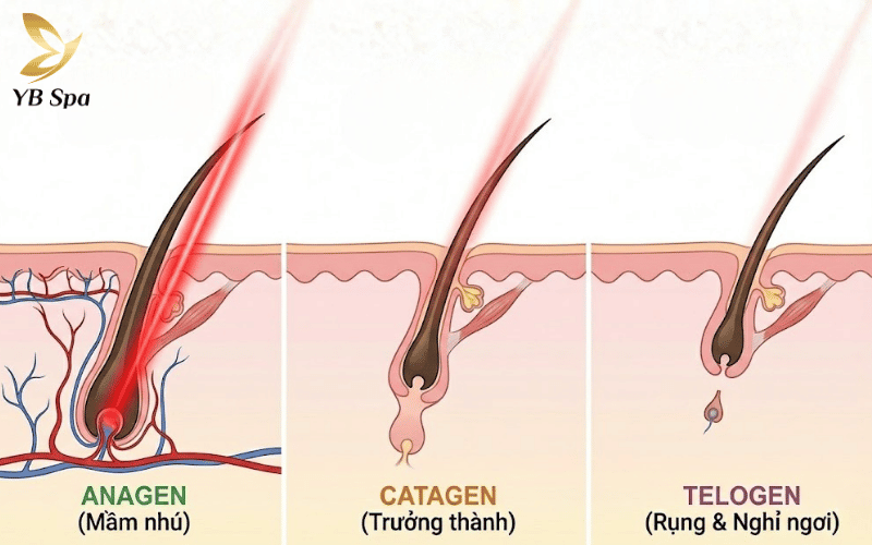 Vì lông phát triển theo từng đợt khác nhau, bạn cần thực hiện đủ số buổi để không bỏ lỡ bất kỳ mầm lông nào trong chu kỳ sinh trưởng