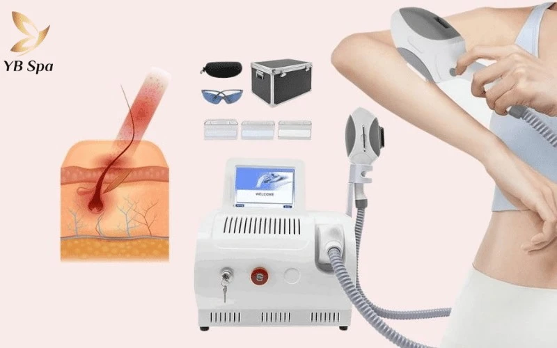 Cơ chế ánh sáng xung vuông của OPT tác động sâu vào nang lông, triệt tiêu nguồn dinh dưỡng nuôi lông.