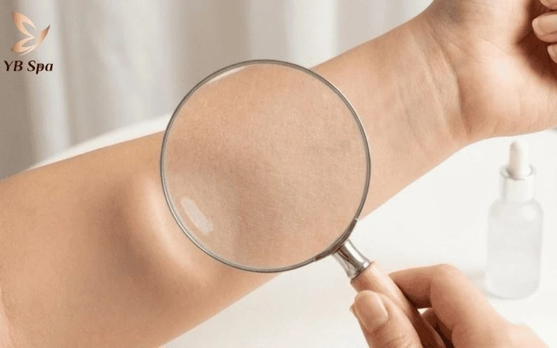 Ánh sáng sinh học từ máy OPT giúp se khít lỗ chân lông và hỗ trợ điều trị viêm nang lông.