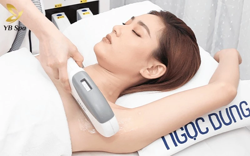 Top 8 Spa Triệt Lông Quận 1 Uy Tín, An Toàn, Chất Lượng 17 triet long quan 1 8