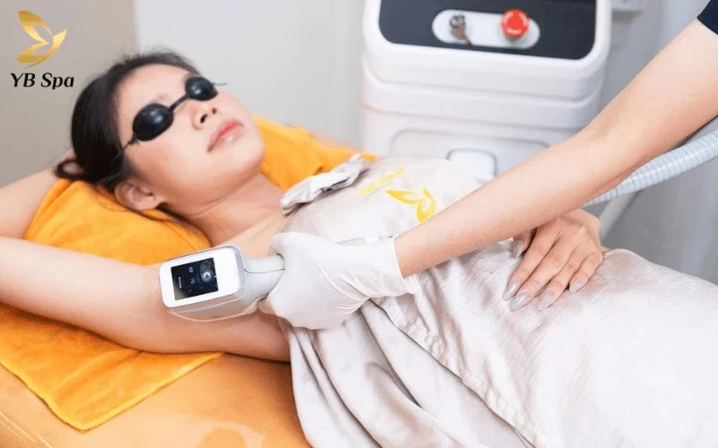 Tiết kiệm tối đa chi phí làm đẹp với các gói triệt lông trọn gói tại YB Spa đang được ưu đãi giảm sâu đến 70%