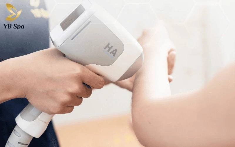Top 5 Địa Chỉ Triệt Lông Quận 3 Uy Tín, Hiện Đại 3