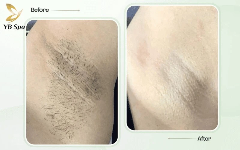 Sự giao thoa giữa công nghệ cao và tinh chất hữu cơ tại Oshora giúp khách hàng vừa dọn sạch vi-ô-lông, vừa nuôi dưỡng làn da mịn màng, khỏe khoắn