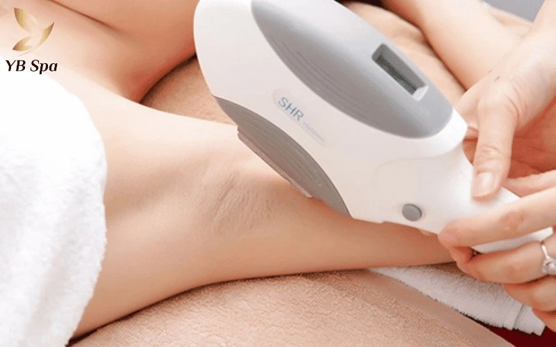 Công nghệ triệt lông SHR sử dụng ánh sáng quang học giúp triệt tiêu nang lông an toàn, hiệu quả.