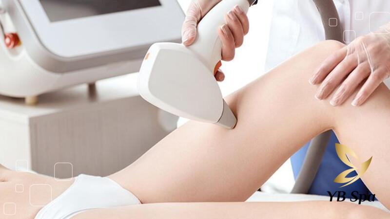 Triệt Lông Vĩnh Viễn Bằng IPL Có Tốt Không? 8 Cần thực hiện nhiều lần triệt lông theo định kỳ để đảm bảo triệt hết các giai đoạn phát triển của lông (Nguồn: Internet)