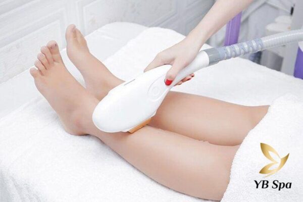 Phương pháp triệt lông bằng IPL (Nguồn: Internet)