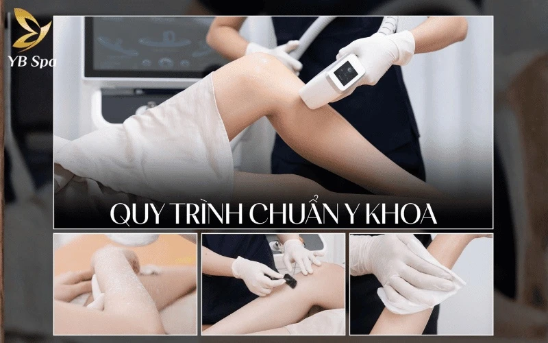 Quy trình khép kín tại YB Spa không chỉ triệt lông sạch sâu mà còn chú trọng bảo vệ và nuôi dưỡng làn da mịn màng
