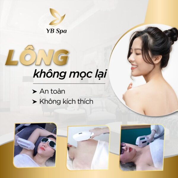 Triệt Lông Vĩnh Viễn Quận 9 (Nguồn: YB Spa)