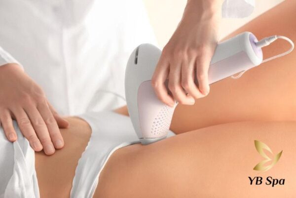 Triệt lông vùng kín bằng laser được nhiều chị em ưa chuộng (Nguồn: YB Spa)