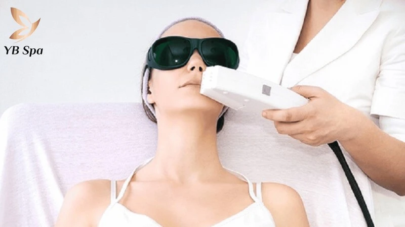 Triệt lông bằng công nghệ Laser hiện đại giúp hạn chế tối đa tổn thương và ngăn lông mọc lại.