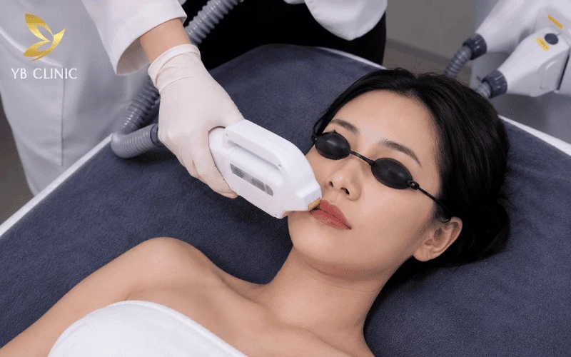 6 Cách Triệt Ria Mép Nữ An Toàn Và Hiệu Quả 7 Triệt ria mép bằng công nghệ Diode Laser tại spa giúp loại bỏ lông mép hiệu quả, hạn chế mọc lại và mang đến làn da mịn màng.