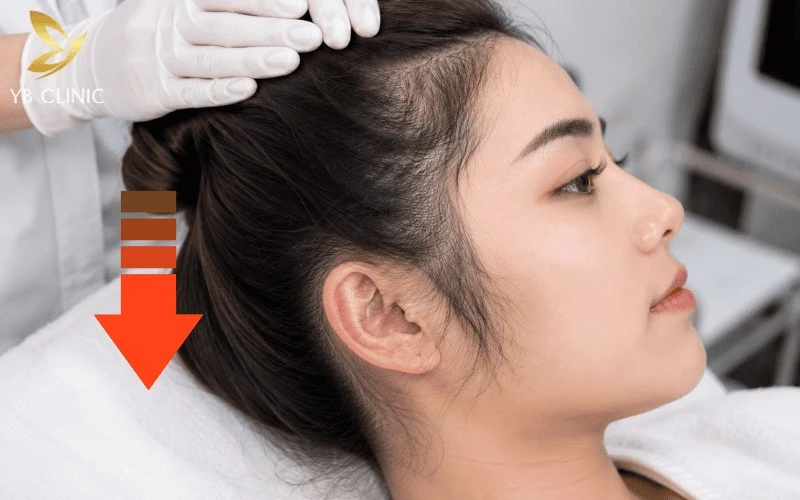 Triệt Tóc Mai Cho Nam Nữ Có Nên Không? Lợi Ích Và Rủi Ro Tiềm Ẩn 10 Triệt tóc mai công nghệ cao giúp giảm tóc rậm, làm sợi tóc mảnh hơn và duy trì vùng mặt gọn gàng.