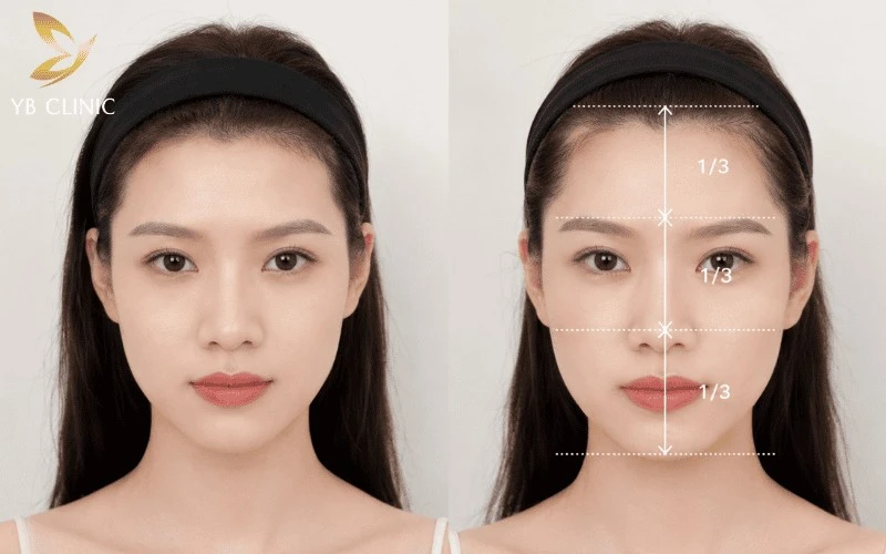 Triệt Tóc Trán Là Gì? Có Nên Triệt Tóc Trán Không? 10 Triệt tóc trán giúp loại bỏ phần tóc con mọc thấp, tạo hiệu ứng vầng trán cao và rộng hơn, giúp gương mặt cân đối, thanh thoát hơn.
