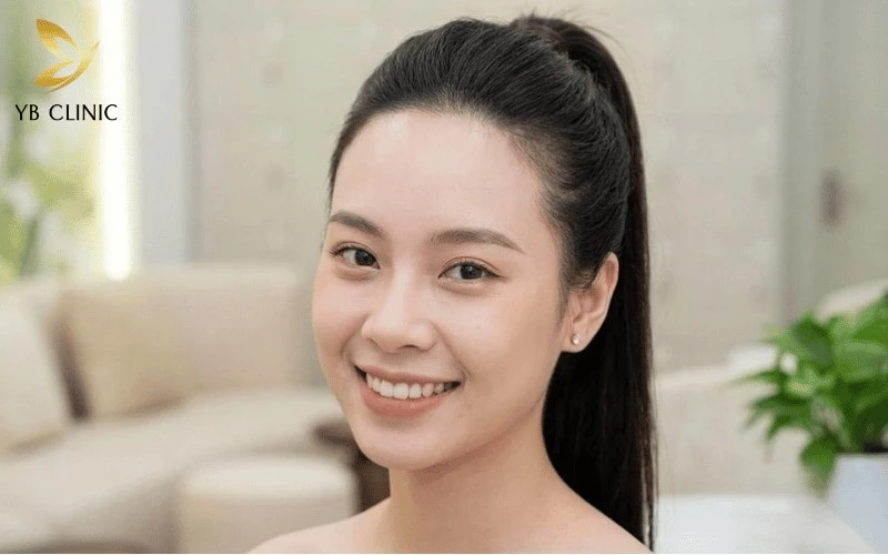 Triệt Tóc Trán Là Gì? Có Nên Triệt Tóc Trán Không? 12 Triệt tóc trán giúp điều chỉnh đường chân tóc, tạo hiệu ứng vầng trán cao, thanh thoát và giúp gương mặt cân đối hơn mà không cần phẫu thuật.