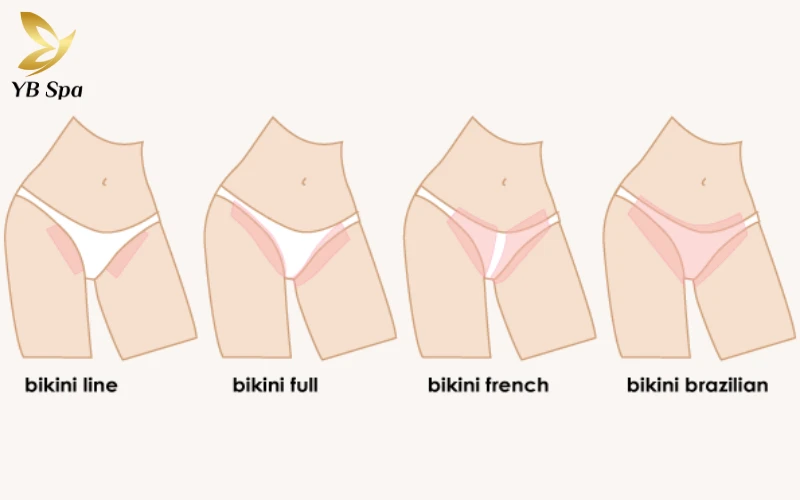 Triệt viền bikini là gì? Có nên triệt không? 11 Triệt viền bikini chỉ dọn dẹp phần lông lộ ra ngoài quần lót, trong khi triệt toàn phần loại bỏ 100% lông để mang lại sự thông thoáng tuyệt đối
