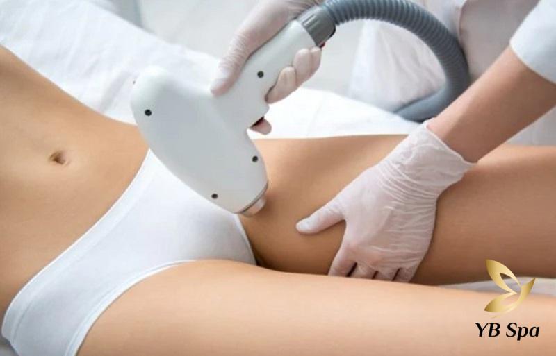 Triệt viền bikini - Có nên triệt lông vùng viền bikini không? 20 Triệt lông bikini bằng công nghệ hiện đại
