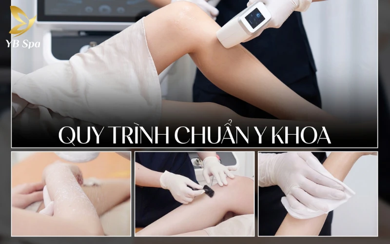 Triệt viền bikini là gì? Có nên triệt không? 16 Quy trình 10 bước chuẩn y khoa giúp bảo vệ tối đa vùng da nhạy cảm và mang lại hiệu quả triệt lông vượt trội, an toàn tuyệt đối