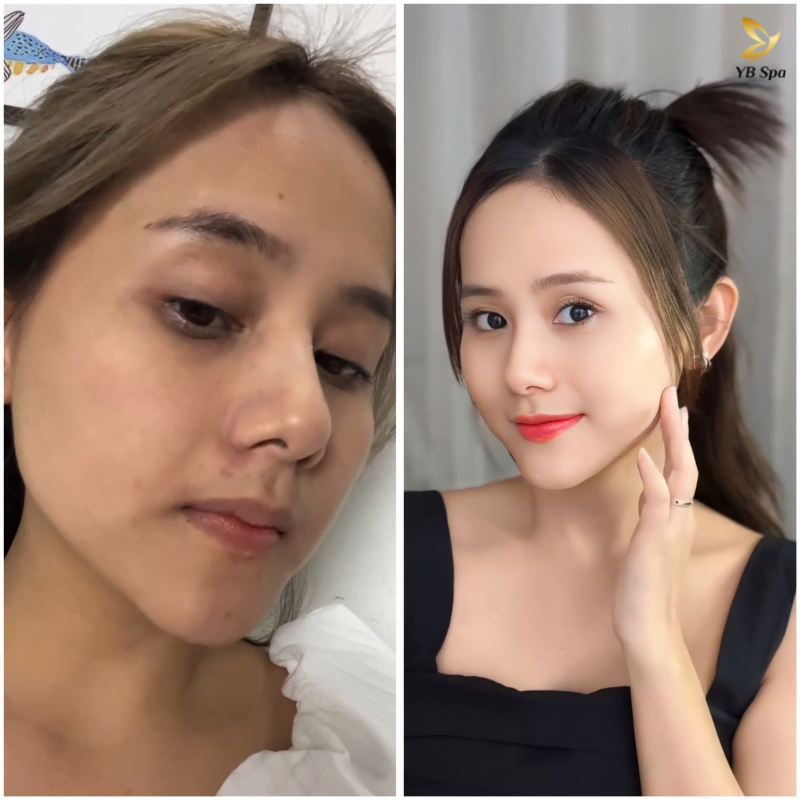 Liệu trình CHRISTINA UNSTRESS - Phủ sương trên làn da tổn thương 17 Điêu khắc ombre chân mày TỰ NHIÊN sắc nét chuẩn TỶ LỆ VÀNG (duplicate)