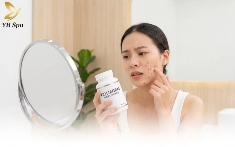 Lo lắng về mụn khi uống collagen