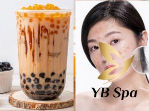 Uống trà sữa có nổi mụn không? Cách uống để không bị nổi mụn