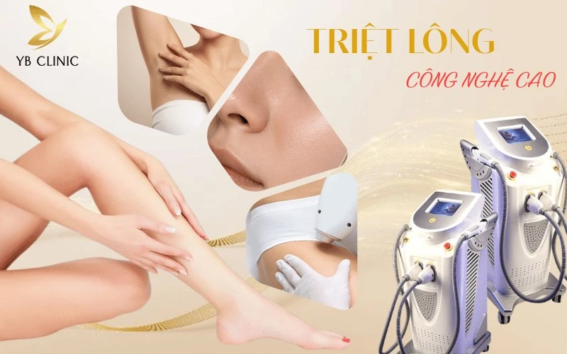 Chương trình ưu đãi triệt lông YB Spa mang lại làn da mịn màng không tì vết.