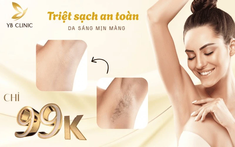 Trải nghiệm dịch vụ triệt lông công nghệ cao tại YB Spa chỉ từ 99K.