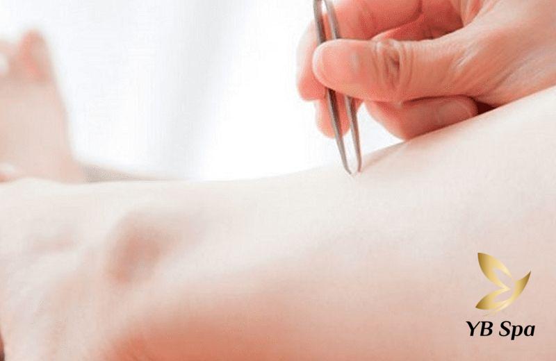 Ưu Nhược Điểm Của Phương Pháp Triệt Lông Truyền Thống 23 Phương pháp nhổ lông (Nguồn: Internet)