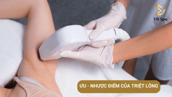 Uu Nhuoc Diem Triet Long