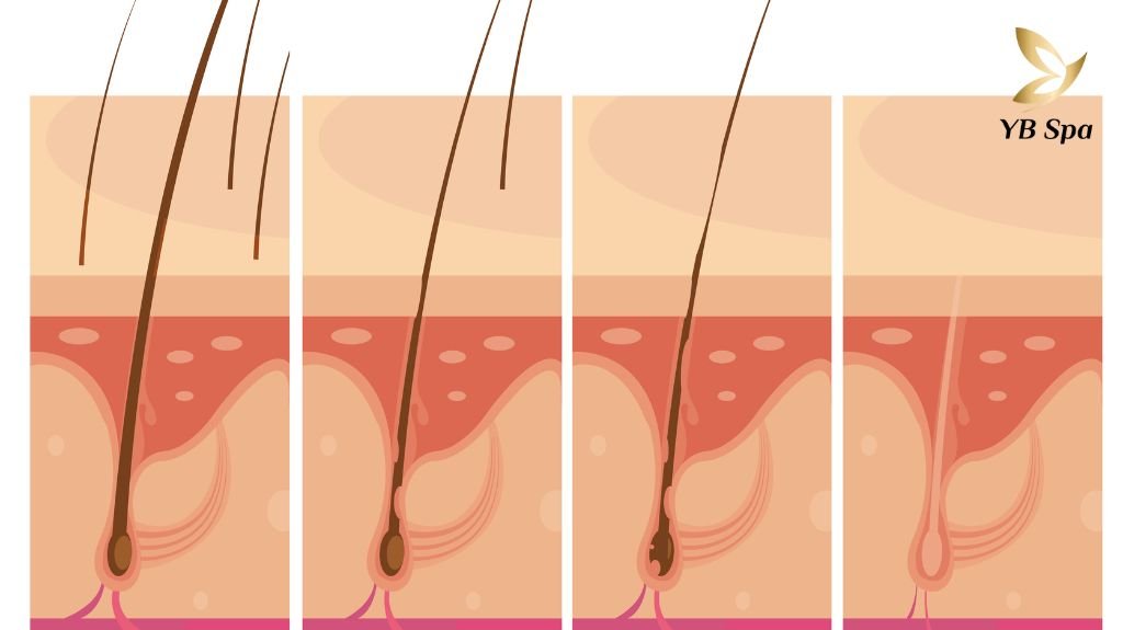 Vì Sao Nên Đi Triệt Lông? 6 Lý Do Bạn Nên Triệt Lông Ngay Hôm Nay 22 Vì sao nên đi triệt lông?