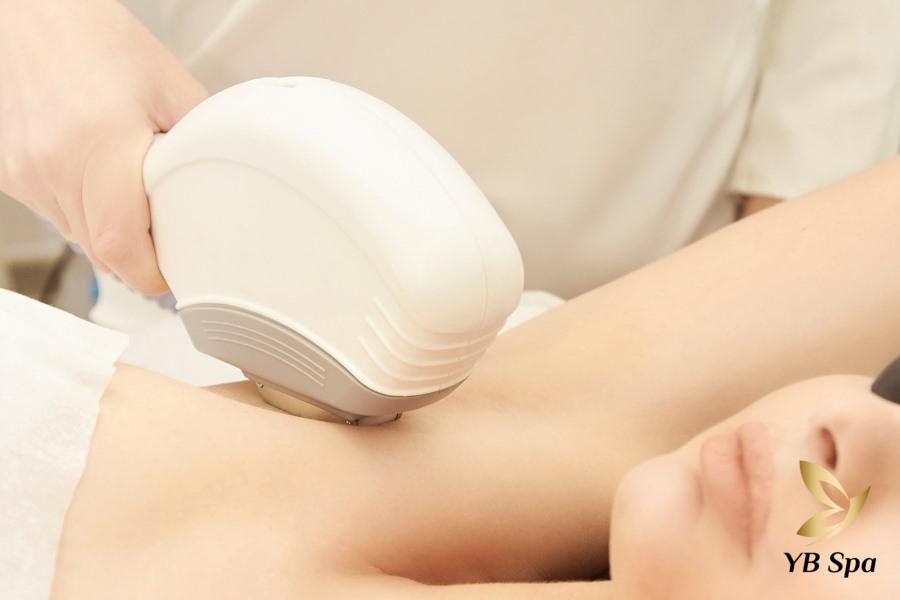 Viêm nang lông nách là gì? Nguyên nhân và cách phòng ngừa 33 Triệt lông nách bằng phương pháp laser